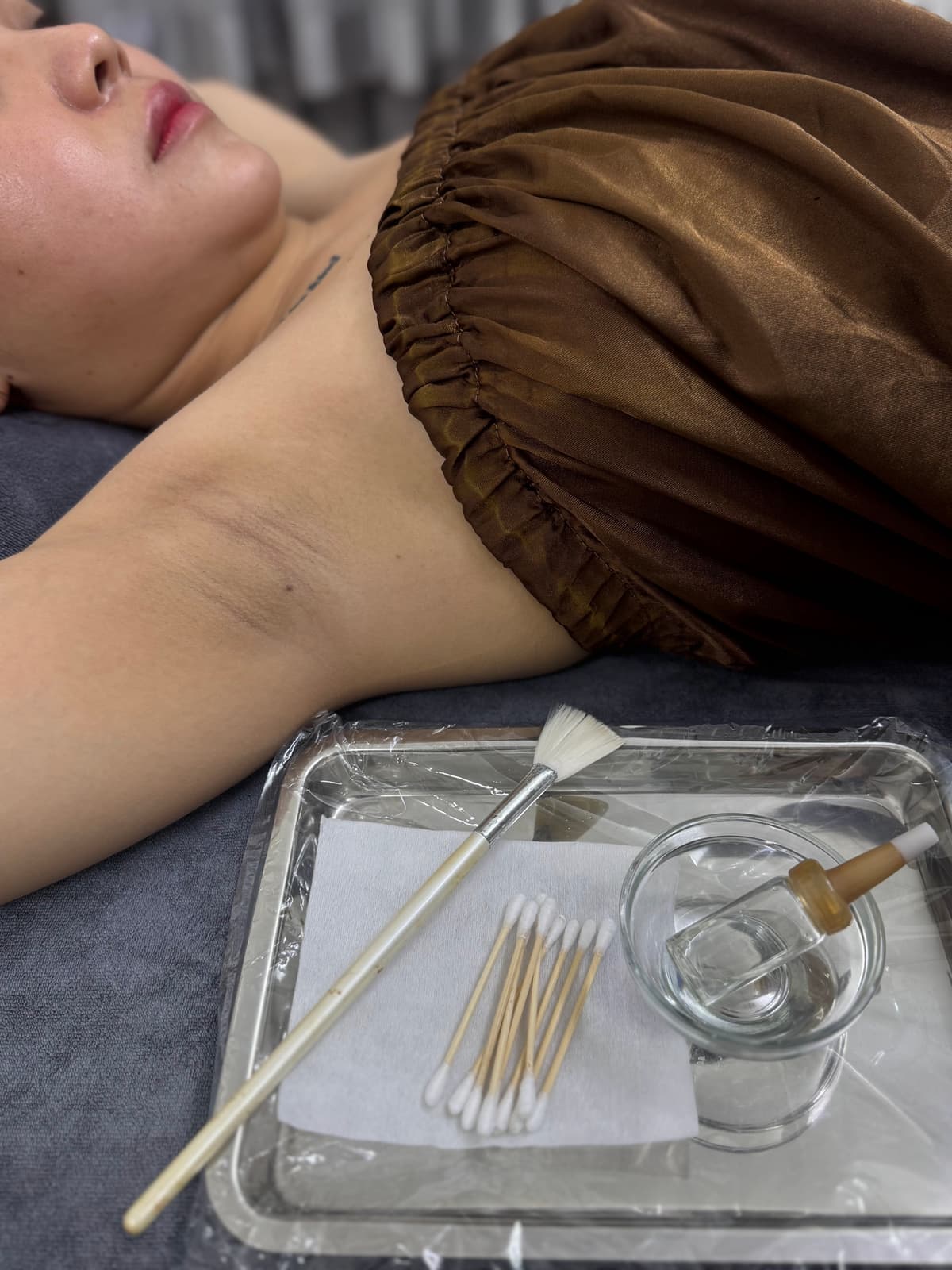 Quy trình chuẩn bị peeling trị thâm nách — vệ sinh và thoa axit AHA/BHA